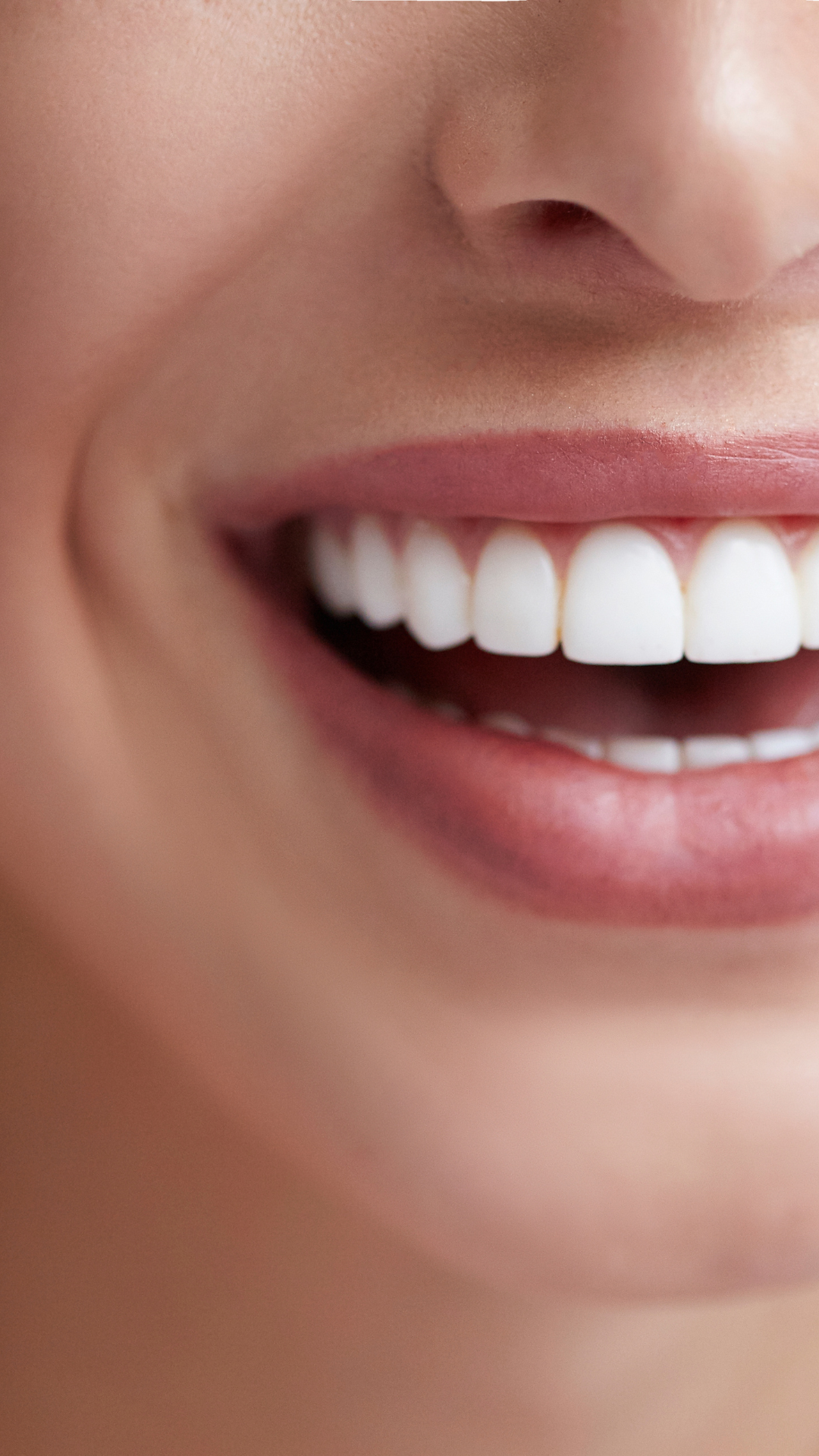 Clareamento Dentário Tecnológico azul Minimalista instagram post